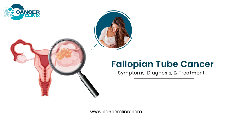 Fallopian Tube Cancer Symptoms Diagnosis And Treatment Cancerclinix